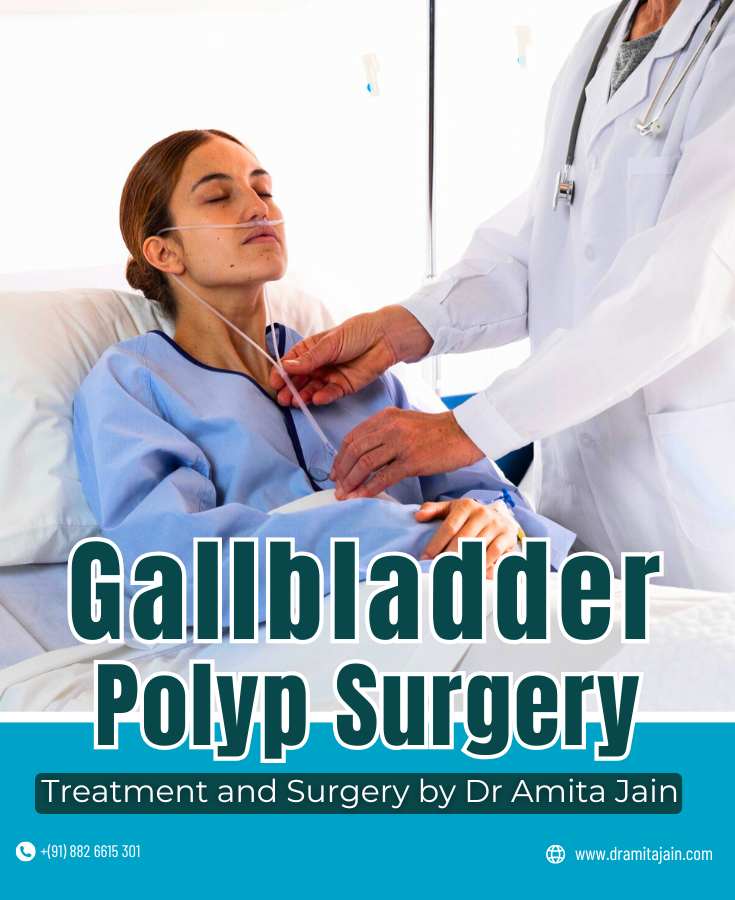 Gallbladder Polyp Surgery by Dr Amita Jain